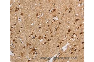 Immunohistochemistry of Human brain  using KCNG4 Polyclonal Antibody at dilution of 1:40 (KCNG4 anticorps)