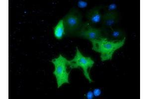 Anti-MTMR14 mouse monoclonal antibody (ABIN2453334) immunofluorescent staining of COS7 cells transiently transfected by pCMV6-ENTRY MTMR14 (RC207732). (MTMR14 anticorps)