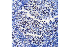 Immunohistochemistry of paraffin-embedded mouse spleen using BRG1/SM antibody (ABIN7270655) at dilution of 1:100 (40x lens). (SMARCA4 anticorps)