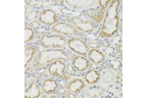 Immunohistochemistry of paraffin-embedded rat kidney using MT-ND5 antibody (ABIN6135116, ABIN6144435, ABIN6144437 and ABIN6224158) at dilution of 1:100 (40x lens).