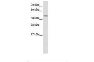 Image no. 1 for anti-SWI/SNF Related, Matrix Associated, Actin Dependent Regulator of Chromatin, Subfamily A, Member 1 (SMARCA1) (N-Term) antibody (ABIN202389)
