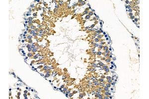 ABIN6260022 and ABIN6276440 at 1/100 staining Rat testis tissue by IHC-P. (ARF6 anticorps  (Internal Region))
