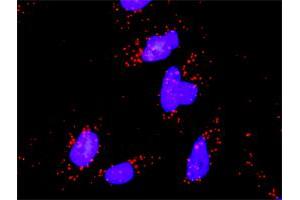 Proximity Ligation Analysis of protein-protein interactions between CRK and MAPK8.