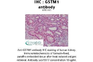 Image no. 1 for anti-Glutathione S-Transferase mu 1 (GSTM1) (AA 1-159) antibody (ABIN1735304)