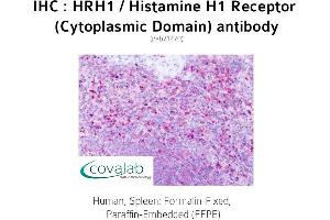 Image no. 1 for anti-Histamine Receptor H1 (HRH1) (3rd Cytoplasmic Domain) antibody (ABIN1735570)