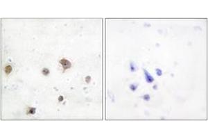 Immunohistochemistry analysis of paraffin-embedded human brain tissue, using JIP2 Antibody. (IB2 anticorps  (AA 581-630))