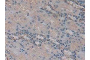 DAB staining on IHC-P; Samples: Human Kidney Tissue (IGFBP6 anticorps  (AA 31-240))