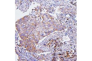 IHC analysis of CETP using anti-CETP antibody (ABIN7602439).