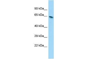 WB Suggested Anti-EEFSEC Antibody Titration: 1. (EEFSEC anticorps  (C-Term))