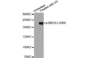 Western blot analysis of extracts from Hela cells using Phospho-BRCA1-S988 antibody.