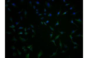 Immunofluorescence staining of U251 cells with ABIN7171646 at 1:100, counter-stained with DAPI. (TBC1D3G anticorps  (AA 312-549))