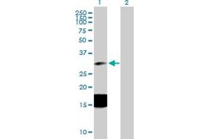 Western Blot analysis of ESM1 expression in transfected 293T cell line by ESM1 MaxPab polyclonal antibody. (ESM1 anticorps  (AA 1-184))