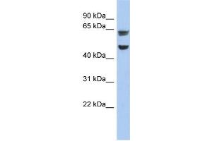 WB Suggested Anti-ZP1 Antibody Titration: 0. (ZP1 anticorps  (Middle Region))