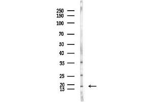 Western blot analysis of lysates from LoVo cells(heat-shock,45 min treatment), using ZNHI Antibody at 1/1000 dilution.