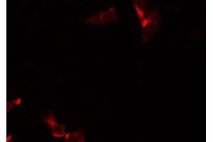 ABIN6266833 staining Hela by IF/ICC. (ARMCX3 anticorps  (N-Term))