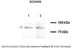 A549, H441 (SCNN1B anticorps  (C-Term))