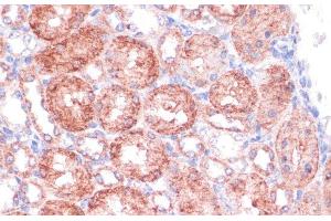 Immunohistochemistry of paraffin-embedded Rat kidney using SHMT1 Polyclonal Antibody at dilution of 1:100 (40x lens).