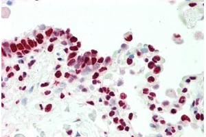 Human, Lung: Formalin-Fixed Paraffin-Embedded (FFPE)