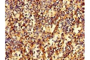 Immunohistochemistry of paraffin-embedded human spleen tissue using ABIN7167270 at dilution of 1:100