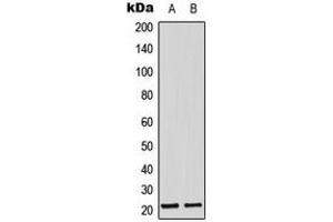 Western blot analysis of Adrenomedullin expression in MCF7 (A), mouse lung (B) whole cell lysates. (Adrenomedullin anticorps  (Center))