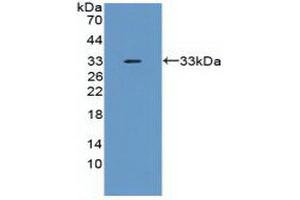 Western blot analysis of recombinant Mouse TNFaIP6.