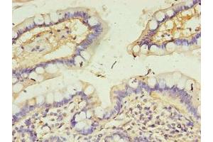 Immunohistochemistry of paraffin-embedded human small intestine tissue using ABIN7146497 at dilution of 1:100 (CALML4 anticorps  (AA 1-120))