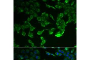 Immunofluorescence analysis of HeLa cells using C1R Polyclonal Antibody (C1R anticorps)
