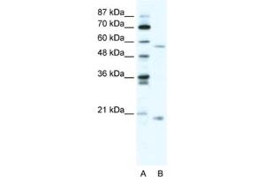 Western Blotting (WB) image for anti-Zinc Finger Protein 18 (ZNF18) antibody (ABIN2460737) (ZNF18 anticorps)