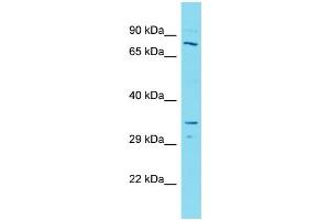 Host:  Rabbit  Target Name:  SMARCB1  Sample Type:  Lymph Node Tumor lysates  Antibody Dilution:  1.