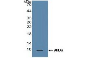 Detection of Recombinant BRCA1, Human using Polyclonal Antibody to Breast Cancer Susceptibility Protein 1 (BRCA1) (BRCA1 anticorps  (AA 19-83))