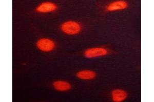 ABIN6267691 staining HeLa cells by ICC/IF.