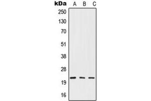 Western blot analysis of IFN beta expression in HepG2 (A), mouse liver (B), rat liver (C) whole cell lysates. (IFNB1 anticorps  (Center))