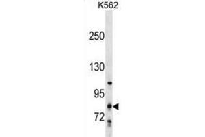 Western Blotting (WB) image for anti-Glycosyltransferase 25 Domain Containing 2 (GLT25D2) antibody (ABIN2999969) (GLT25D2 anticorps)