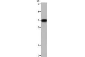 Gel: 6 % SDS-PAGE, Lysate: 40 μg, Lane: Mouse heart tissue, Primary antibody: ABIN7129956(KCND3 Antibody) at dilution 1/700, Secondary antibody: Goat anti rabbit IgG at 1/8000 dilution, Exposure time: 30 seconds (KCND3 anticorps)