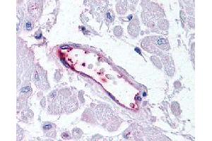 Immunohistochemical (Formalin/PFA-fixed paraffin-embedded sections) staining in human vascular endothelium with HUNK polyclonal antibody . (HUNK anticorps)