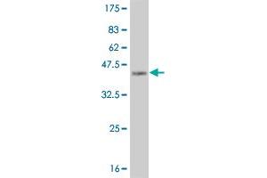 Western Blot detection against Immunogen (37.