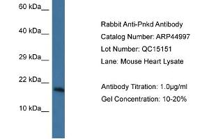 WB Suggested Anti-Pnkd Antibody   Titration: 1. (PNKD anticorps  (N-Term))