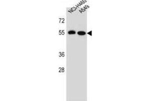 Western Blotting (WB) image for anti-Leucine Rich Repeat Containing 6 (LRRC6) antibody (ABIN2996353)
