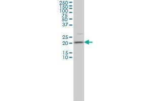 TAGLN3 monoclonal antibody (M01), clone 1D2 Western Blot analysis of TAGLN3 expression in IMR-32 . (Transgelin 3 anticorps  (AA 1-199))