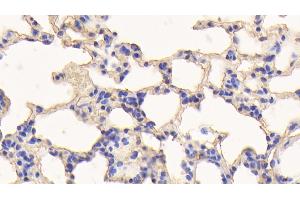Detection of ALB in Rat Lung Tissue using Polyclonal Antibody to Albumin (ALB)