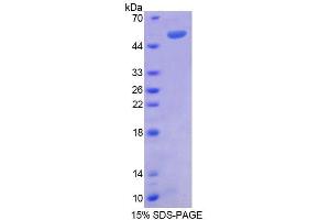 SDS-PAGE analysis of Human RGS1 Protein. (RGS1 Protéine)