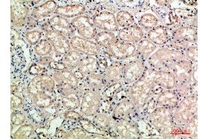 Immunohistochemical analysis of paraffin-embedded human-kidney, antibody was diluted at 1:200 (Selectin E/CD62e anticorps)