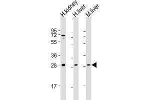 All lanes : Anti-SIRT3 Antibody (C-term) at 1:2000 dilution Lane 1: human kidney lysate Lane 2: human liver lysate Lane 3: mouse liver lysate Lysates/proteins at 20 μg per lane. (SIRT3 anticorps  (C-Term))