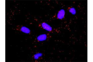 Proximity Ligation Analysis of protein-protein interactions between PIK3R5 and PIK3CG.