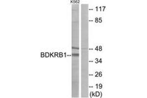 Western blot analysis of extracts from K562 cells, using BDKRB1 Antibody. (BDKRB1 anticorps  (AA 201-250))