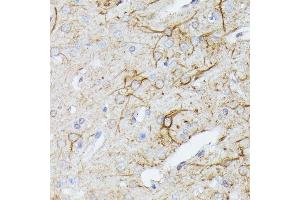 Immunohistochemistry of paraffin-embedded rat brain using TBCA antibody (ABIN6131384, ABIN6148884, ABIN6148885 and ABIN6216894) at dilution of 1:100 (40x lens). (TBCA anticorps  (AA 1-108))