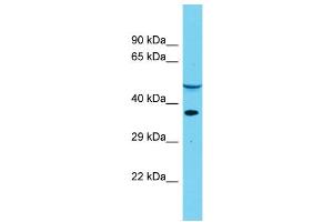 Host: Rabbit Target Name: DUS4L Sample Type: Placenta lysates Antibody Dilution: 1. (DUS4L anticorps  (Middle Region))