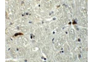 Immunohistochemical staining of mouse brain cells with RABGEF1 polyclonal antibody  at 5 ug/mL. (RABGEF1 anticorps  (Internal Region))