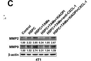 XIAOPI formula inhibits the proliferation and invasion of 4T1 cells co-cultured with TAMs and HSPCs.