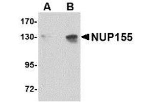 Image no. 1 for anti-Nucleoporin 155kDa (NUP155) (C-Term) antibody (ABIN342687) (NUP155 anticorps  (C-Term))